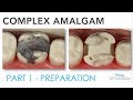 COMPLEX AMALGAM PART 1: PREPARATION