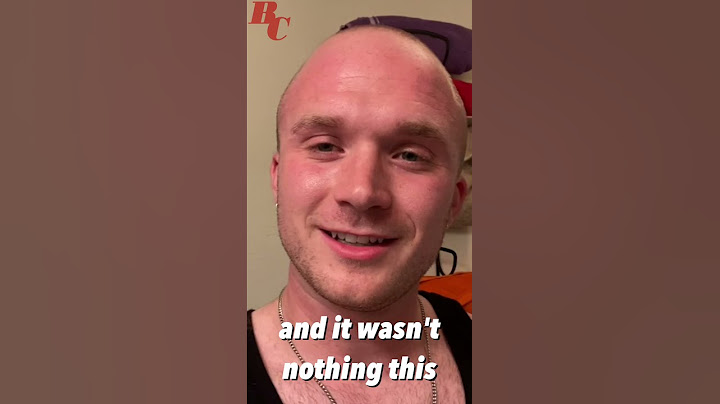 BALDING INSECURITIES Were Holding Me Back