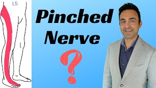 Lumbar Radiculopathy: 'Pinched Nerve' in the lowerback