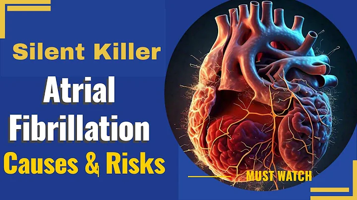 Atrial Fibrillation(AFib) the silent killer: Causes and Risks       #FreeHealthyTips #Health