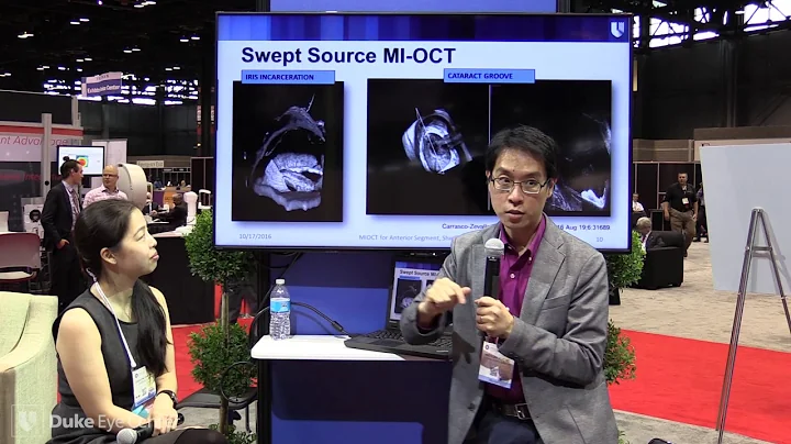 Microscope Integrated OCT for Anterior Segment - A...
