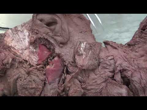 Anatomy 2 Cranial Cavity & Face Dr Ali By MansoOOour & Salim Adel