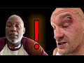 &#39;IT WAS BLESSINGS IN DISGUISE FOR TYSON FURY TO HAVE MORE TIME FROM THE CUT&#39;~ LENNOX LEWIS