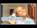 GET RID OFF OLD STRETCH MARK / STRETCH MARK OIL PRODUCT REVIEWS/ SKINCARE REVIEWS (HIGHLY REQUESTED)