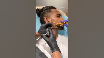 Non-Invasive Face Transformation in Ahmedabad, India | Jawline and Chin Augmentation