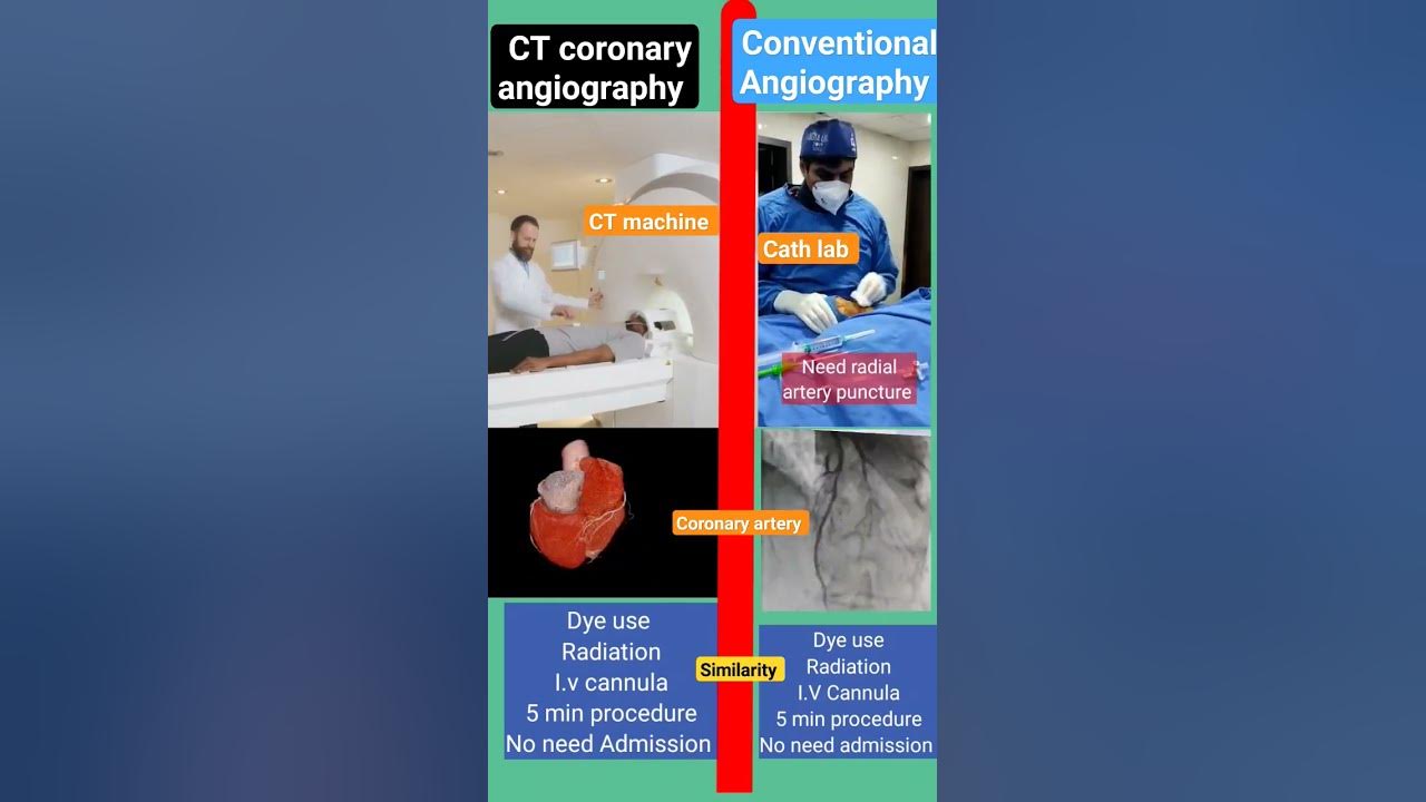 CT coronary versus Conventional coronary angiography l #heart #echo #angiography CT coronary versus Conventional coronary angiography l #heart #echo #angiography