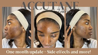 MY ACCUTANE JOURNEY | ONE MONTH UPDATE | SIDE EFFECTS, ACNE AND HYPERPIGMENTATION