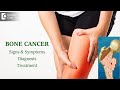 Bone cancer types causes symptoms diagnosis  bone marrowdr mangesh p kamath  doctors circle