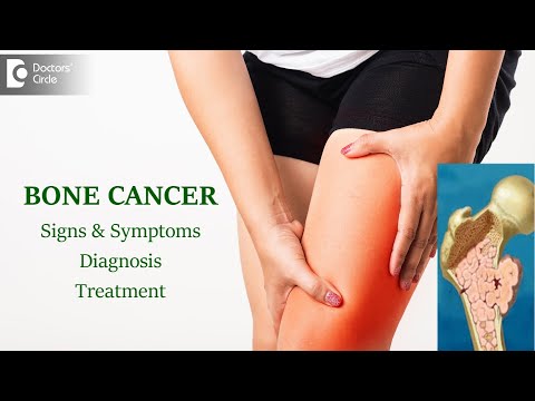 Bone Cancer: Types, Causes, Symptoms, Diagnosis | Bone Marrow-Dr. Mangesh P Kamath | Doctors&rsquo; Circle