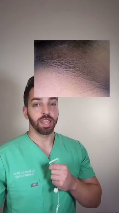 Dark Neck? Acanthosis Nigricans #shorts