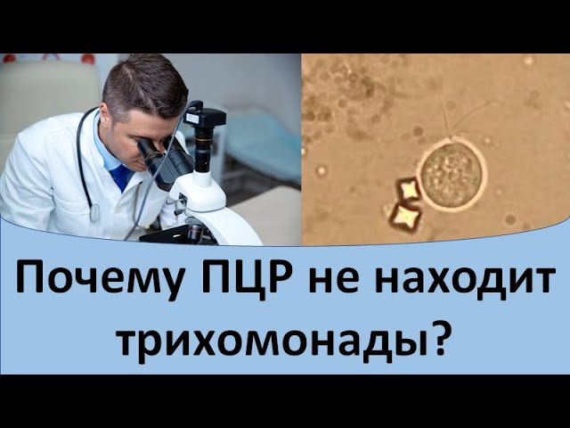 ПЦР-соскоб из уретры у мужчин ПЦР-соскоб из уретры у мужчин