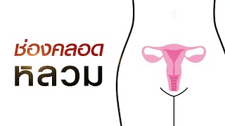 ช่องคลอดหลวม สาเหตุ และวิธีแก้ แนวทางรักษาการแพทย์จีน