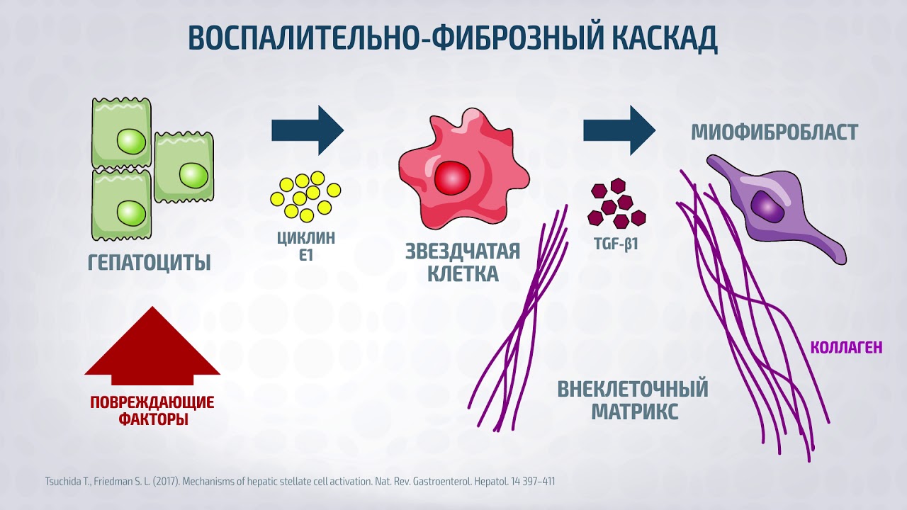 Фиброз после лечения