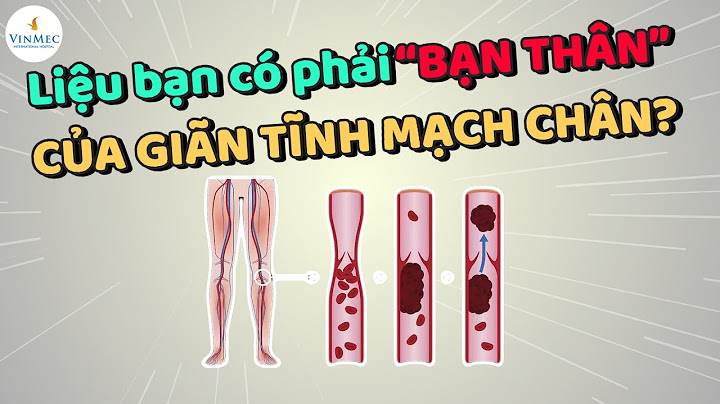 Tính chất nhiệt đới bị giảm sút nghĩa là gì năm 2024