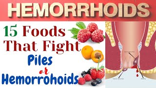 15 Helpful Foods for Hemorrhoids - Best Foods For Piles and Fistula - Foods For Hemorrhoids