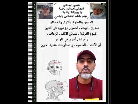 نقطة مهمة تعالج امراض الراس الجنون الصرع الارق الرعاف العين الخفقان امراض اخرى