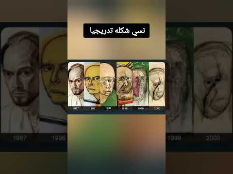 رسام داهمه الزهايمر وبدا ينسى شكل وجهه مره بعد مره