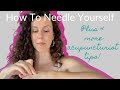 How to needle yourself and 4 other tips for acupuncturists