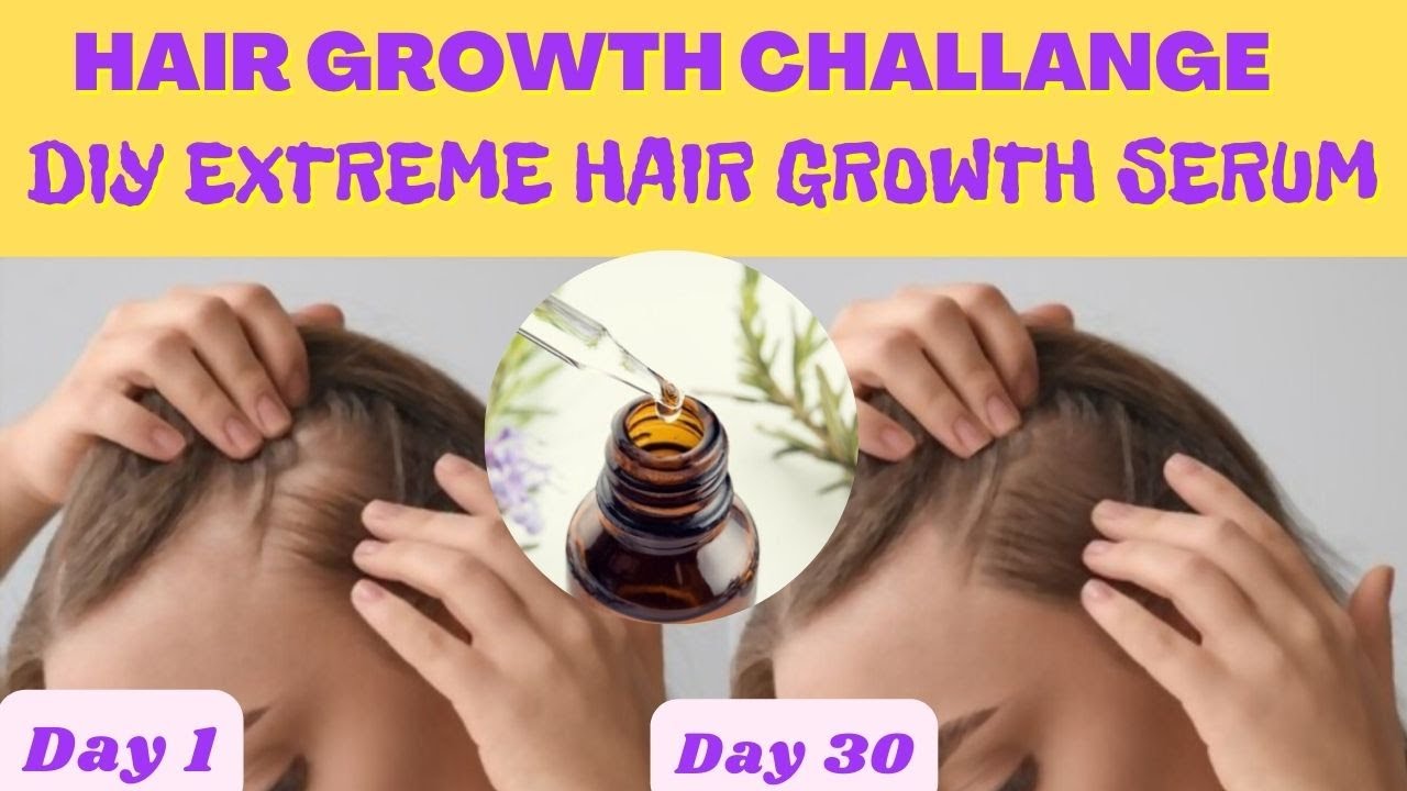 DIY Extreme Hair Growth Serum || Regrow Lost Hair Get Double Density in