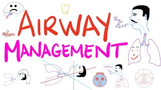 Airway Management | Tracheal Intubation | Anesthesiology screenshot 4