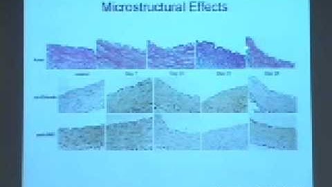 Vascular Mechanobiology: Modeling the Growth of AAA