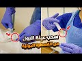 اساسيات التمريض 22 سحب عينة بول من القسطرة البولية Urine Sample Collection From Catheter اساسيات التمريض 22 سحب عينة بول من القسطرة البولية Urine Sample Collection From Catheter
