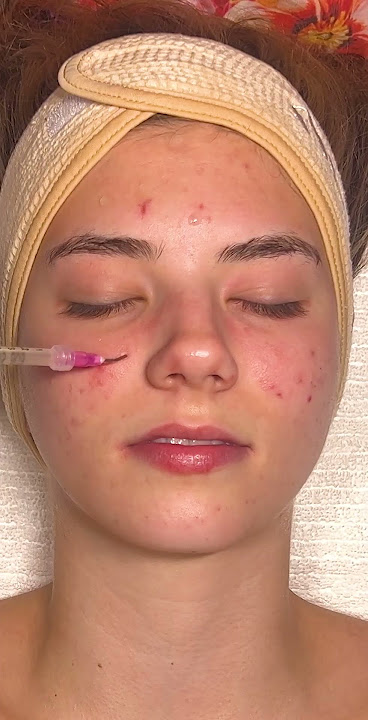 ASMR Relaxing Facial on @katemariess