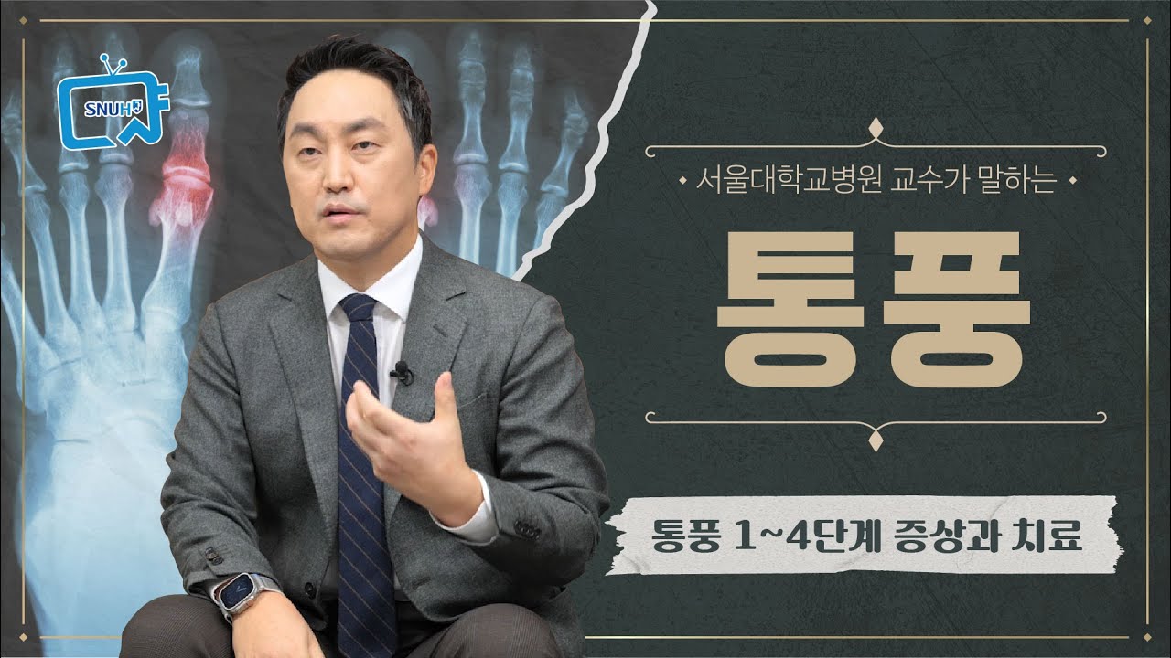 통풍, 가볍게 보면 이렇게 된다! 통풍 1~4단계별 증상과 치료 | 서울대병원 신기철 교수