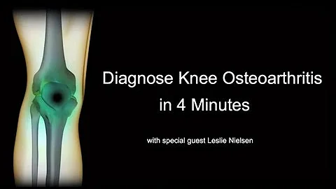 Diagnose Knee Osteoarthritis in 4 Minutes with Les...