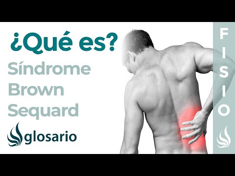 BROWN - SEQUARD | Qué es, qué estructuras afecta, síntomas, signos, causas y tratamiento