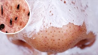 Download Cİldİnİzde Harİkalar Yaratacak 25 Ev Yapimi Maske Video MP3 Cİldİnİzde Harİkalar Yaratacak 25 Ev Yapimi Maske