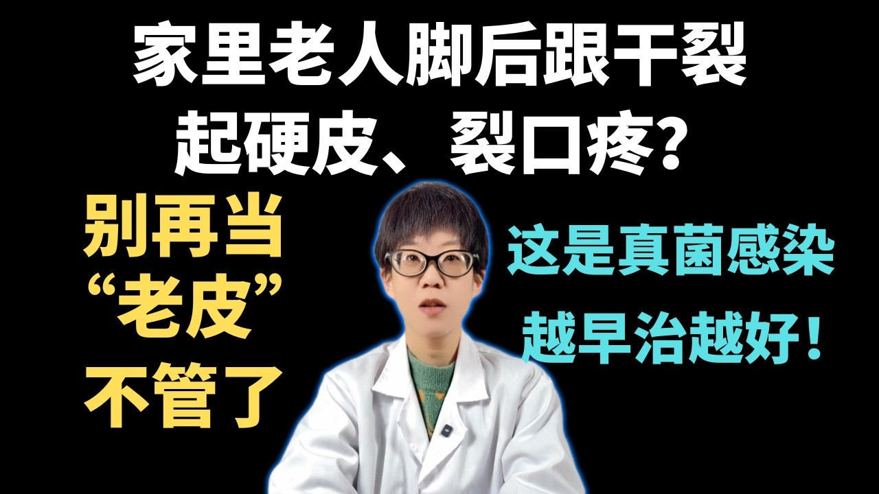 家里老人脚后跟干裂、起硬皮、裂口疼？别再当“老皮”不管了，这是真菌感染，越早治越好！【安澜谈健康】#脚后跟干裂 #脚气 #老年人健康 #鳞屑角化型足癣 #真菌感染 #足部护理 #特比萘芬