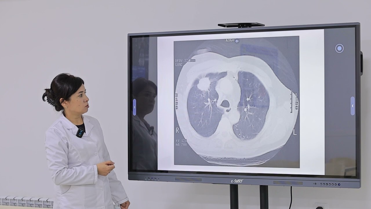 O’pka kasalliklarida nur tashxisi