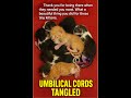 Fan Captured This Kitten Rescue Umbilical Cords Tangled, Legs Turning Purple Kitten Rescue Story