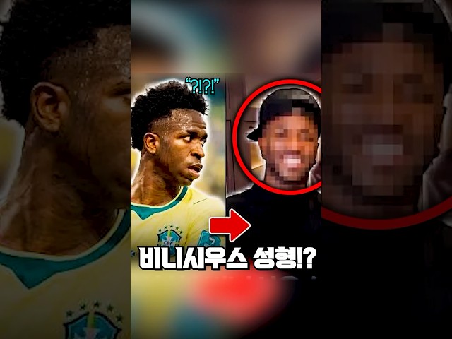 성형 도전한 비니시우스, 얼마나 바뀌었을까?