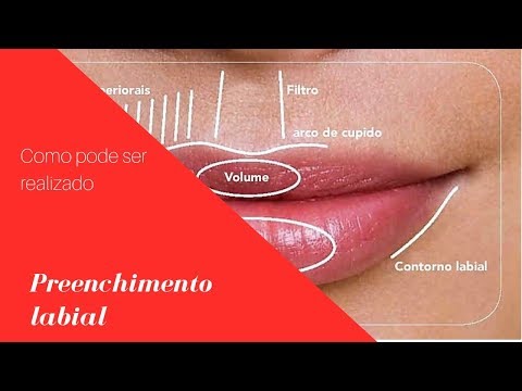 Vídeo: Contorno Labial - Métodos, Conduta, Avaliações