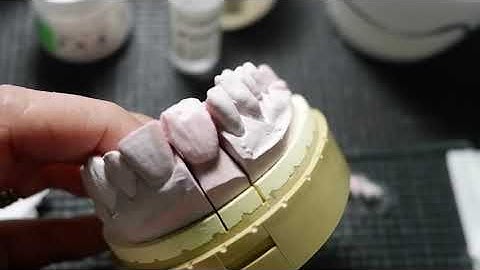 Noritake Ex3 Super Porcelain