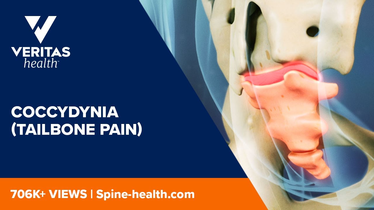 Tailbone Pain aka Coccydynia - Kiran Clinics