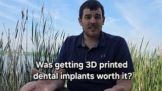 ALL-on-4 3D Printed Dental Implants Q&A 6 Month Update