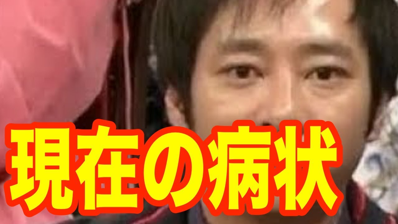 いしだ 壱成 顔面 神経 麻痺