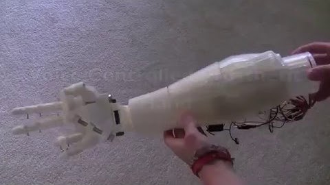 cánh tay giả điều khiển bằng giọng nói tại việt nam