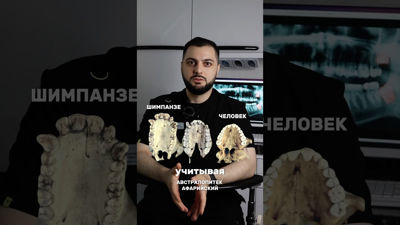 МОЖЕТ ЛИ ЗУБ МУДРОСТИ ВЫРАСТИ РОВНО? 🤔 История зубов мудрости, почему мешают современному человеку