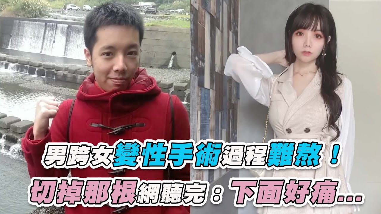 【男跨女變性手術過程難熬！ 全身傷口網聽完：下面好痛...】｜@AllieAllie