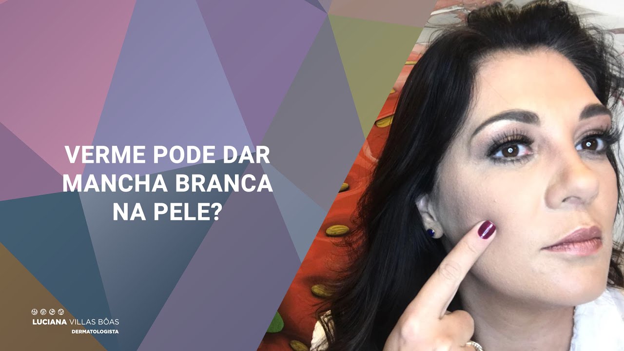 Que Tipo De Verme Causa Mancha Branca Na Pele?