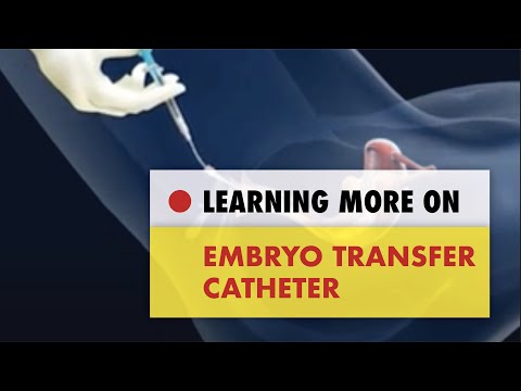 embryo transfer