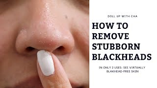 BLACKHEAD FREE IN TWO WEEKS? FEATURING PHILOSOPHY'S PORE EXTRACTOR MASK