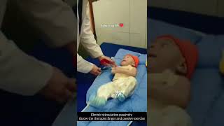 Erbs paralysis treatment at hum saath hai#humsaathhai #dblsocialwelfarefoundation #physiodeptghmc