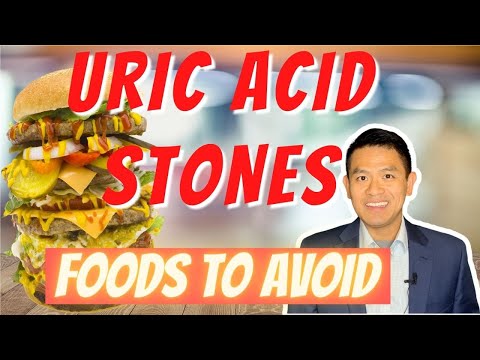 Video: Mga Urinary Tract Stones / Crystals Na Binubuo Ng Uric Acid Sa Mga Aso