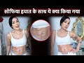 Bigg Boss Fame Sofia Hayat Flaunts Her Scar After Undergoing Massive Cyst Removal Surgery