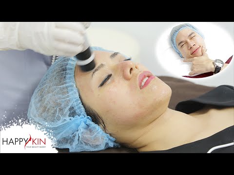 Mặt Nạ Ma Cà Rồng PRP - Phương Pháp Lăn Kim Với Máu Trị Sẹo Rỗ, Mụn, Thâm ft. Hoàng Tôn